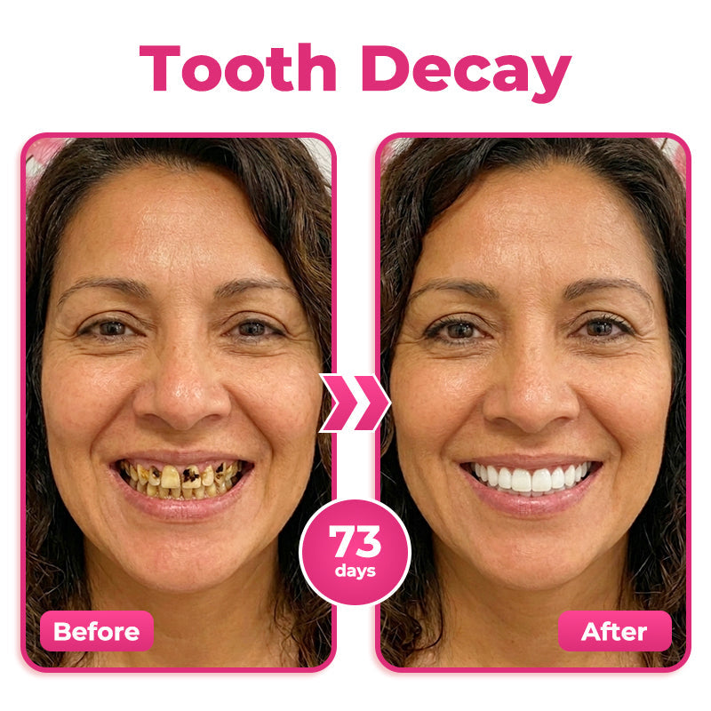 🦷  Natravor® Thismile NH-10 Toothpaste Serum for Enamel & Gum Care – Advanced Therapypy