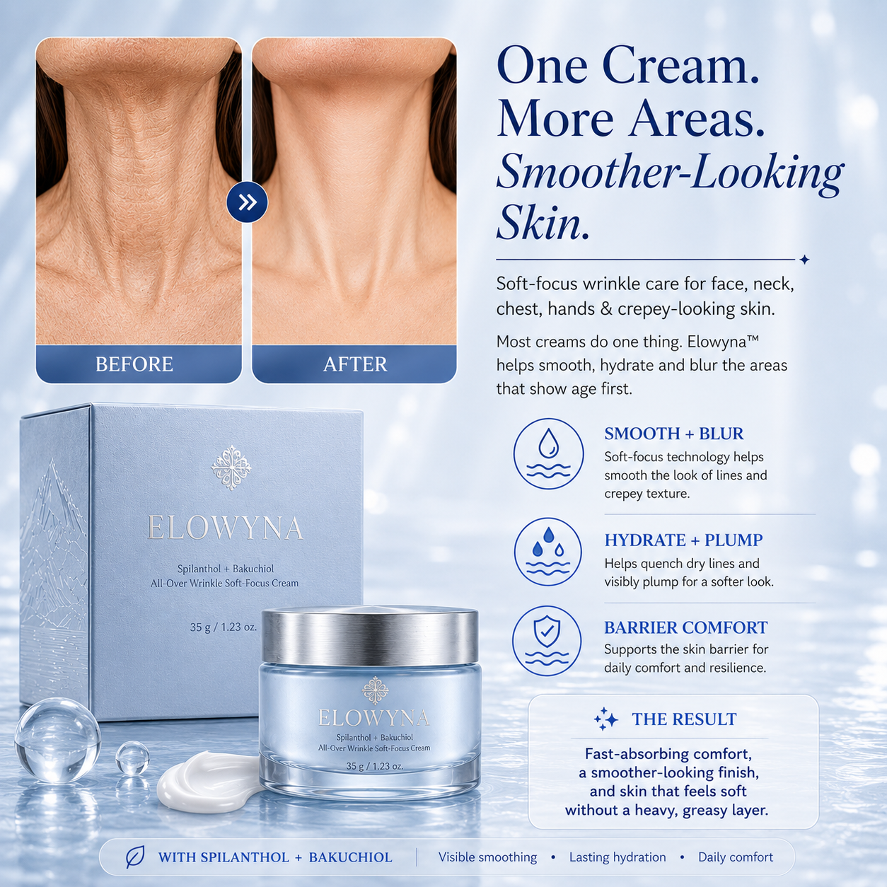 🧠👩‍🔬 Elowyna™ Spilanthol + Bakuchiol All-Over Wrinkle Soft-Focus Cream – Face, Neck, Chest, Hands & Crepey Skin – Smooth, Firm & Blur – 70% OFF Today