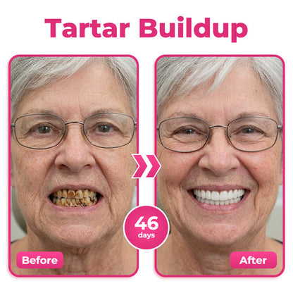 🦷  Natravor® Thismile NH-10 Toothpaste Serum for Enamel & Gum Care – Advanced Therapypy