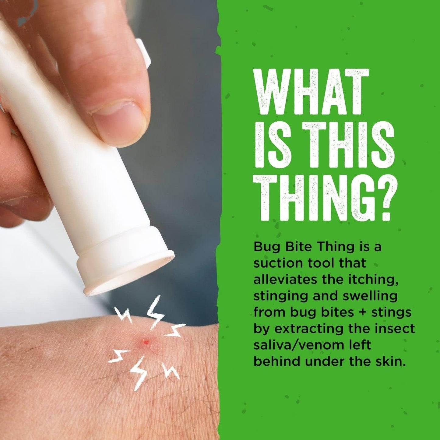 🦟Bug Bite Suction Tool - Relieve itching and swelling✅