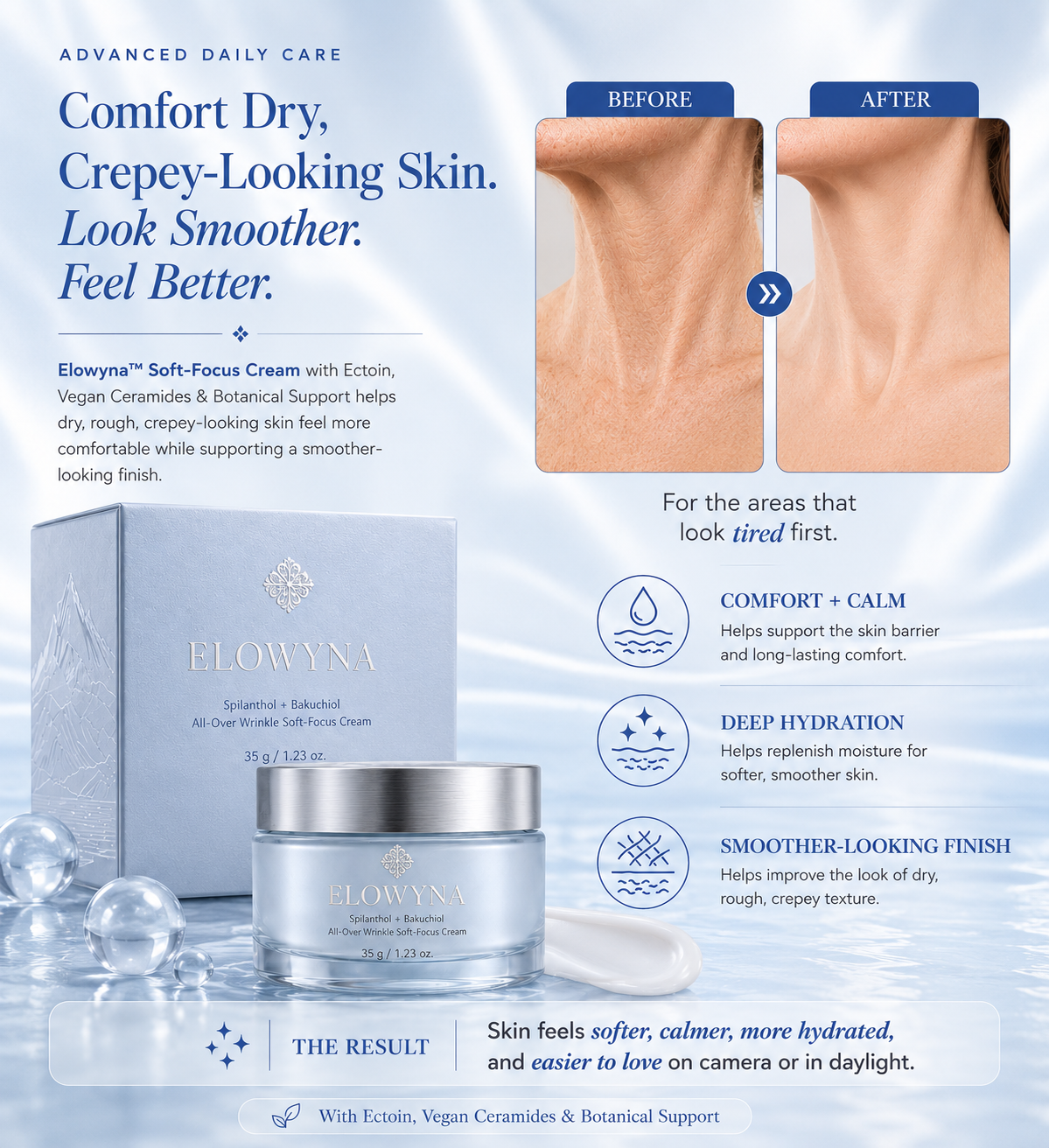 🧠👩‍🔬 Elowyna™ Spilanthol + Bakuchiol All-Over Wrinkle Soft-Focus Cream – Face, Neck, Chest, Hands & Crepey Skin – Smooth, Firm & Blur – 70% OFF Today