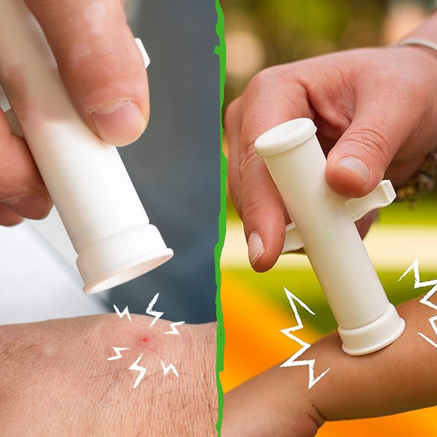 🦟Bug Bite Suction Tool - Relieve itching and swelling✅