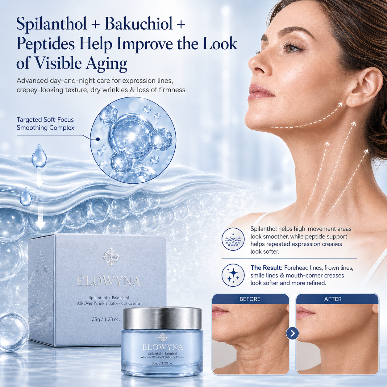🧠👩‍🔬 Elowyna™ Spilanthol + Bakuchiol All-Over Wrinkle Soft-Focus Cream – Face, Neck, Chest, Hands & Crepey Skin – Smooth, Firm & Blur – 70% OFF Today