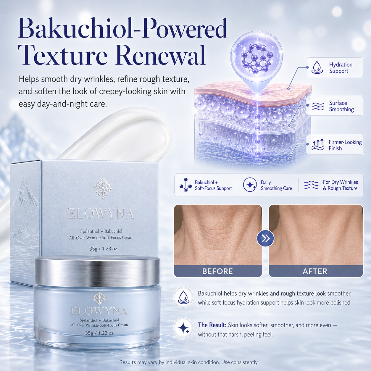🧠👩‍🔬 Elowyna™ Spilanthol + Bakuchiol All-Over Wrinkle Soft-Focus Cream – Face, Neck, Chest, Hands & Crepey Skin – Smooth, Firm & Blur – 70% OFF Today