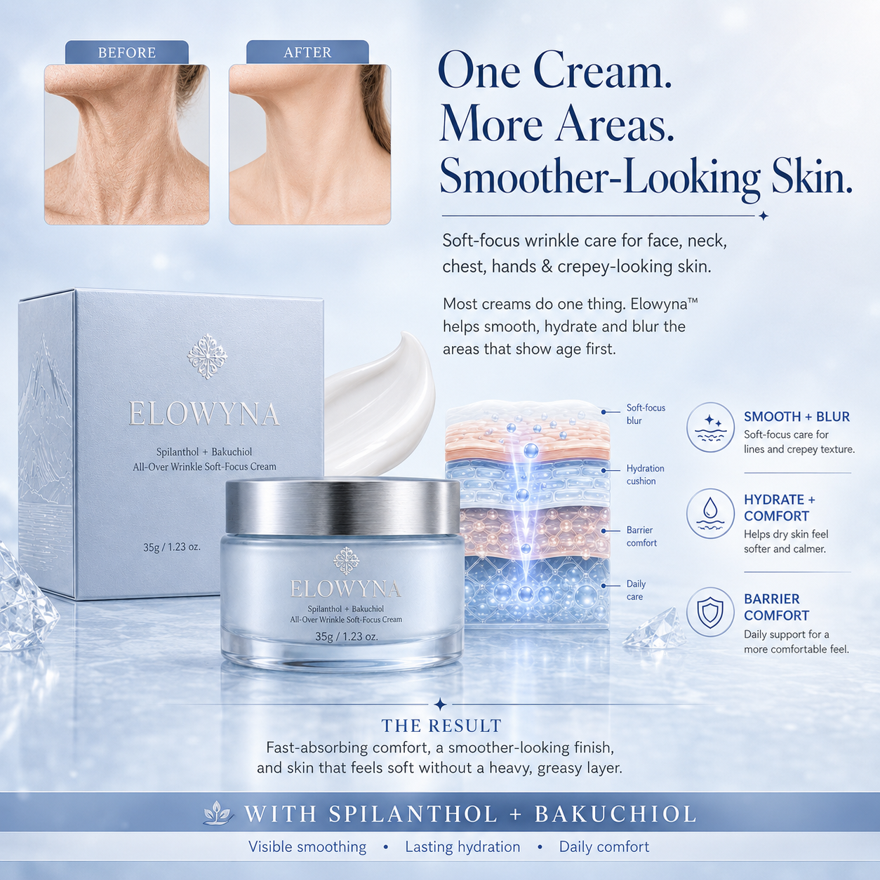 🧠👩‍🔬 Elowyna™ Spilanthol + Bakuchiol All-Over Wrinkle Soft-Focus Cream – Face, Neck, Chest, Hands & Crepey Skin – Smooth, Firm & Blur – 70% OFF Today